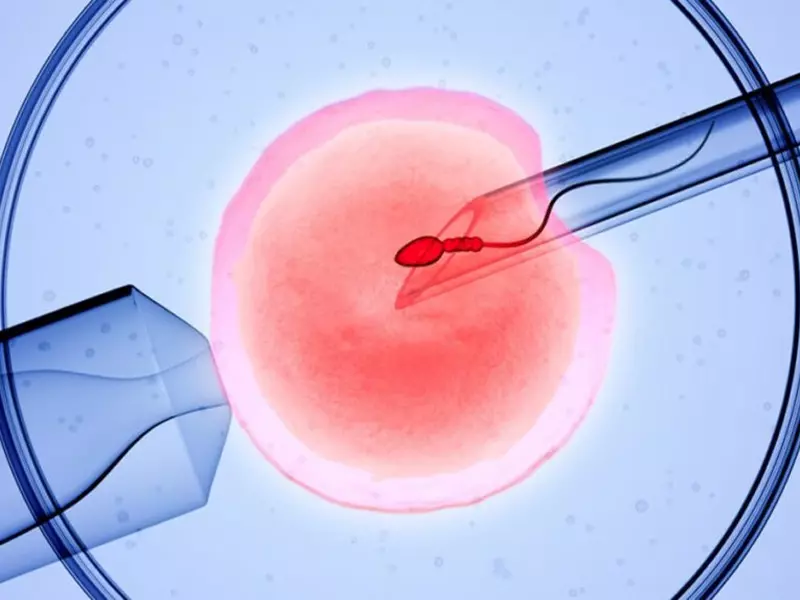 IVF یا لقاح مصنوعی